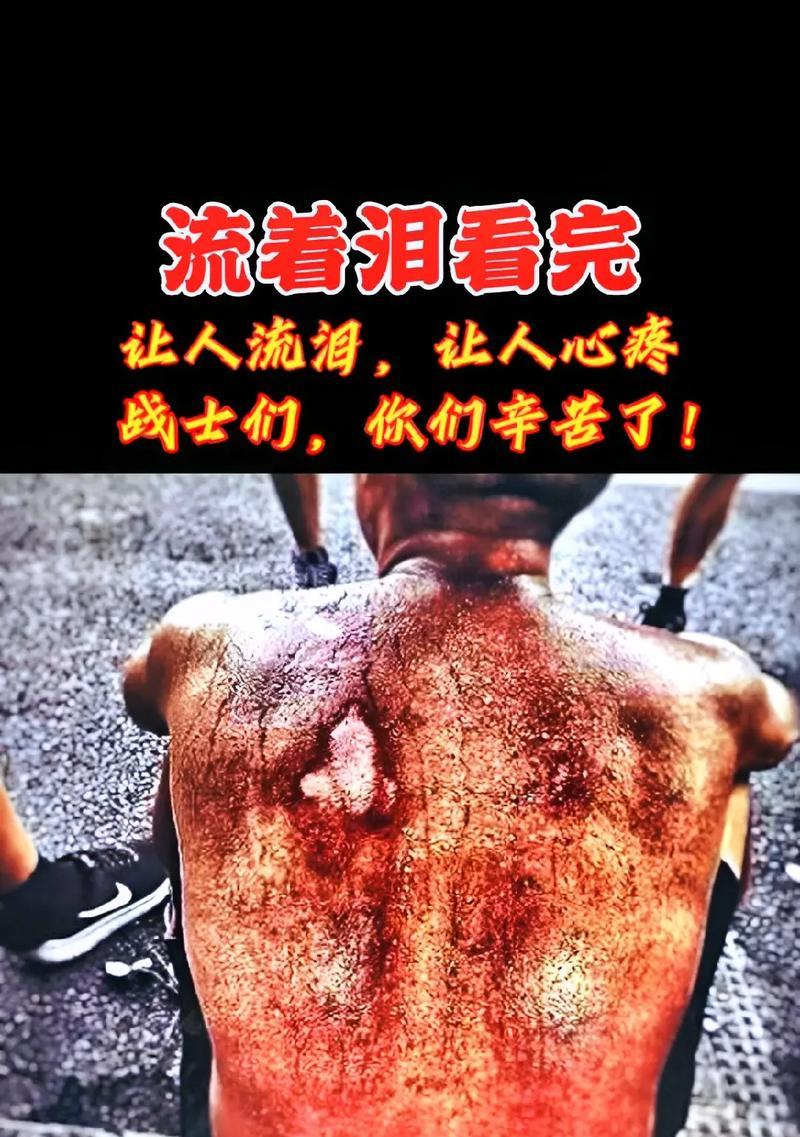 真爱不言弃（一个残疾女孩的梦想）